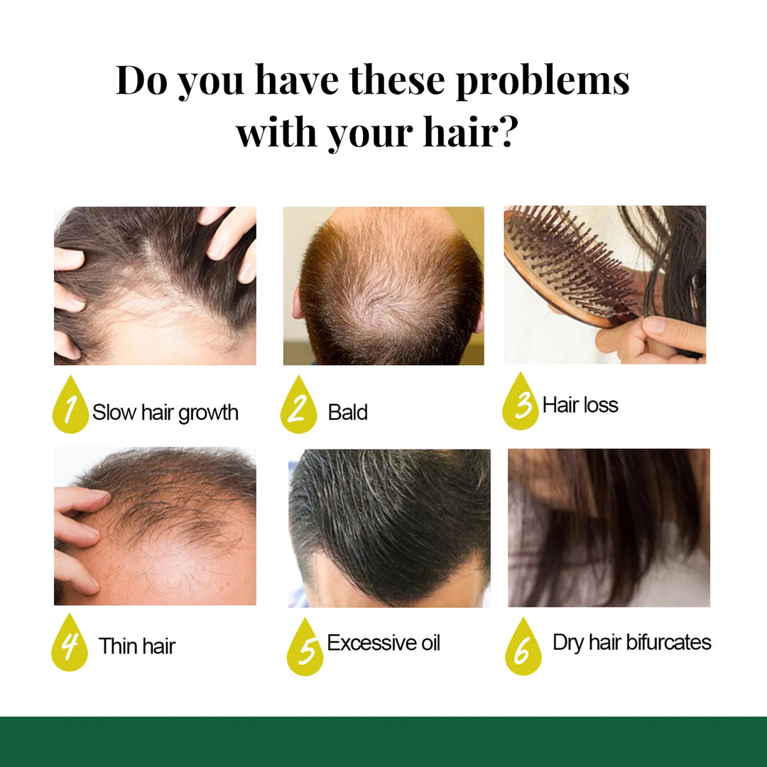 Ginger Care Hair Spray Hair Growth Essence Nourish Hair Roots Massag Scalp Repair Hair Quality Control Oil Hair Care Solution