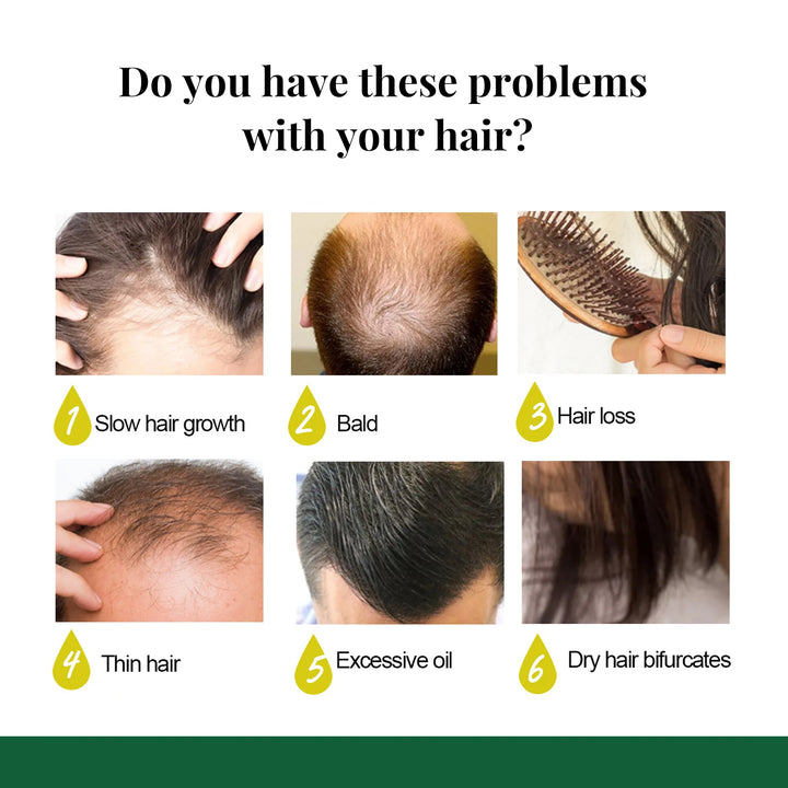 Ginger Care Hair Spray Hair Growth Essence Nourish Hair Roots Massag Scalp Repair Hair Quality Control Oil Hair Care Solution