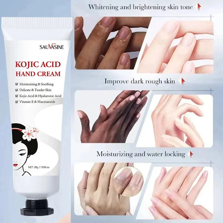 Dark Knuckles Fast Brighten Cream Elbows Hand Knuckle Brightening Serum Knee Black Skin Quickly Lighten Stains Remover Essence