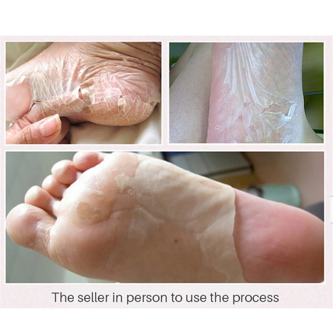 Exfoliating Foot Peel Mask Exfoliating Peel Renewal Foot Mask Soft Remove Dead Skin Pedicure Detox Pads Foot Spa Peel 3ml