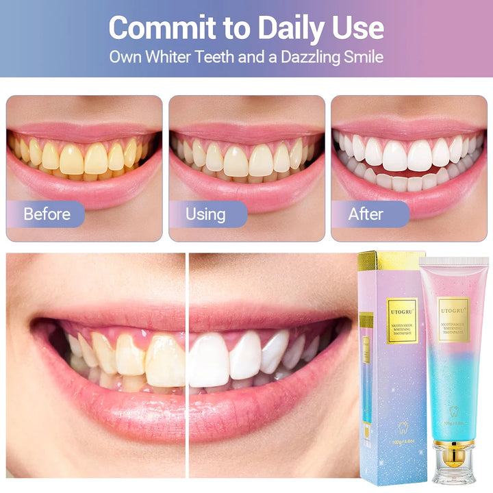 Teeth Whitening Toothpaste Effectively Removes Tea, Coffee, and Wine Stains Fresh Breath Toothpaste for Sensitive Teeth 3 Pack