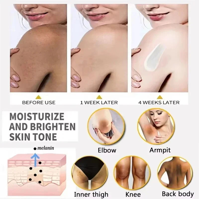 Body Whitening Cream Arms Thighs Underarm Knees Whitening Essence Cream Brighten Moisturizing Body Korean Skin Care Products