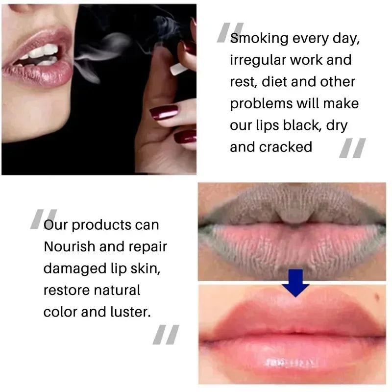 Fast-Acting Dark Lip Balm Leaching Permanent Remove Dark Smoke Lips Lip Balm Moisturize Gloss Lipstick Beauty Health Lip Care