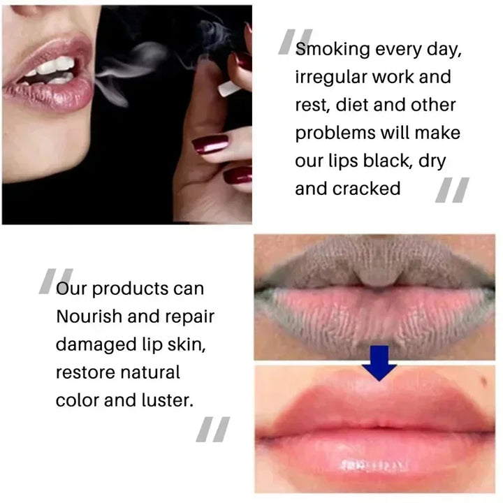 Fast-Acting Dark Lip Balm Leaching Permanent Remove Dark Smoke Lips Lip Balm Moisturize Gloss Lipstick Beauty Health Lip Care