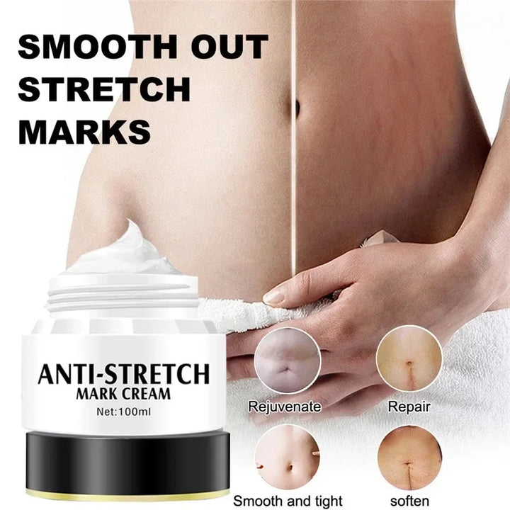 Removes Stretch Mark Cream Postpartum Repair Fade Stretch Marks Prevent Obesity Lifting Firming Moisturizing Brighten Skin Care