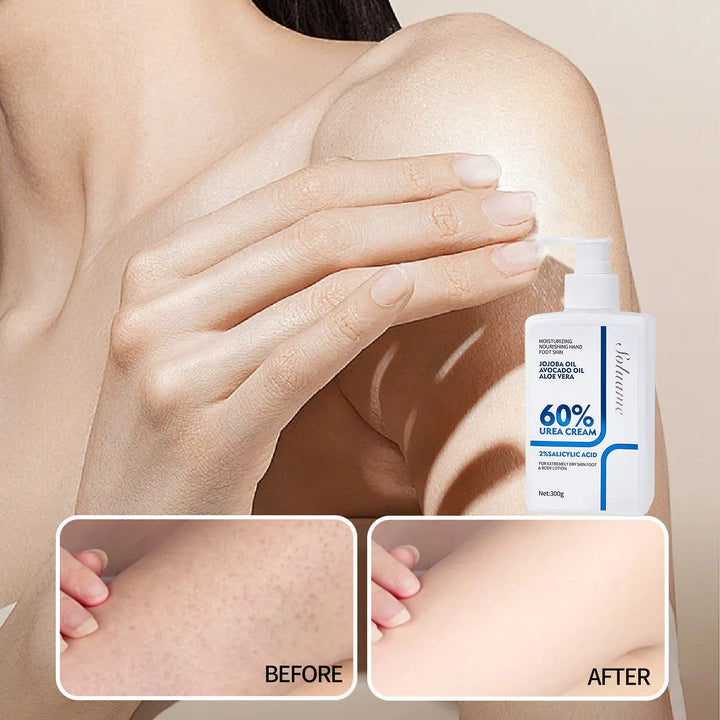 Urea Cream 60% Unisex Whole Body Lotion Moisturizer Hydrates & Nourishes Foot Care for Softening Skin for Dry Cracked Rough Skin