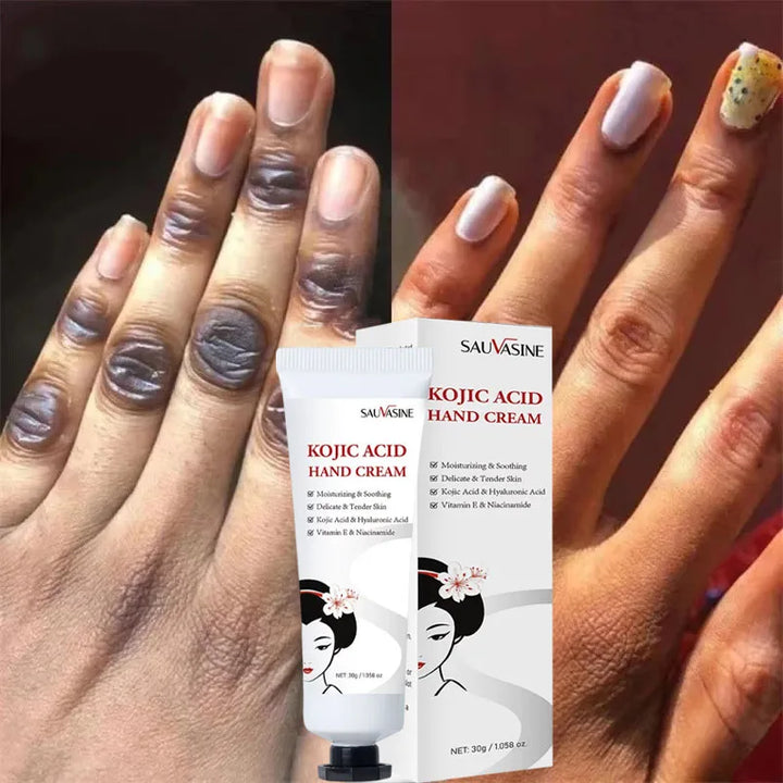 Dark Knuckles Fast Brighten Cream Elbows Hand Knuckle Brightening Serum Knee Black Skin Quickly Lighten Stains Remover Essence