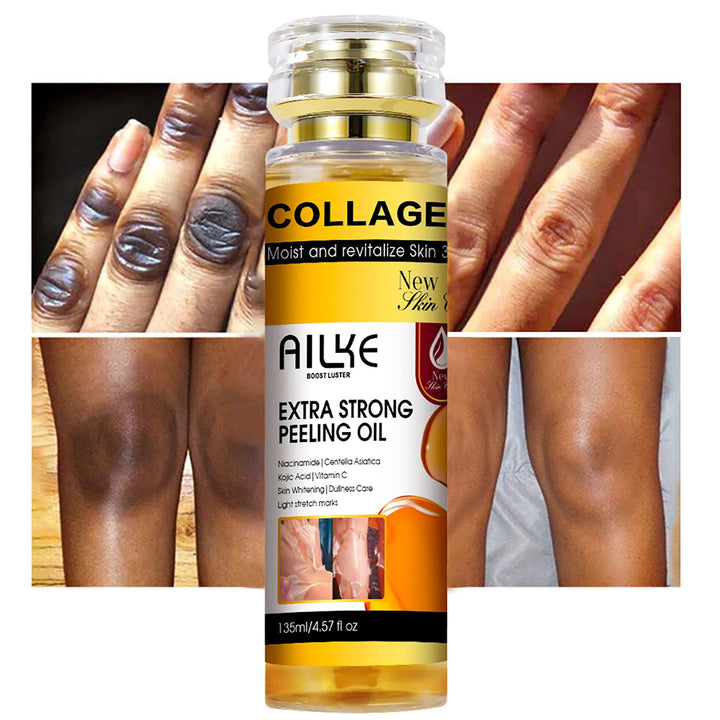AILKE Collagen Extra Strong Peeling Oil, Whitening Skin, Exfoliating Solution for Face, Body, Hand, Feet, for All Skin Types