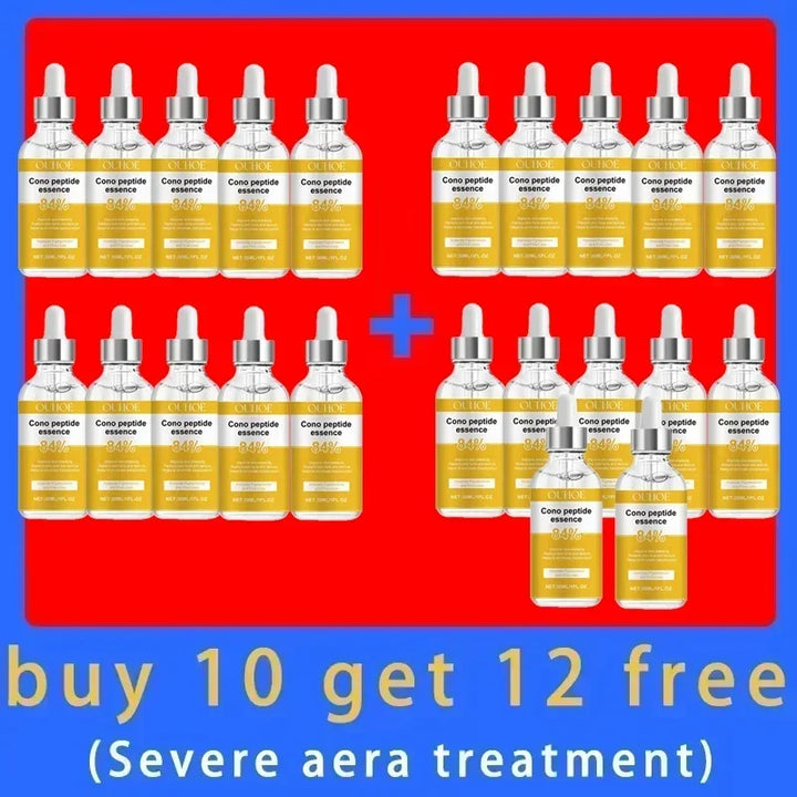 Anti Aging Facial Retinol Serum Improve Skin Alasticity Fade Fine Lines Firming Skin Shrink Pores Reduces Wrinkle Pigmentation