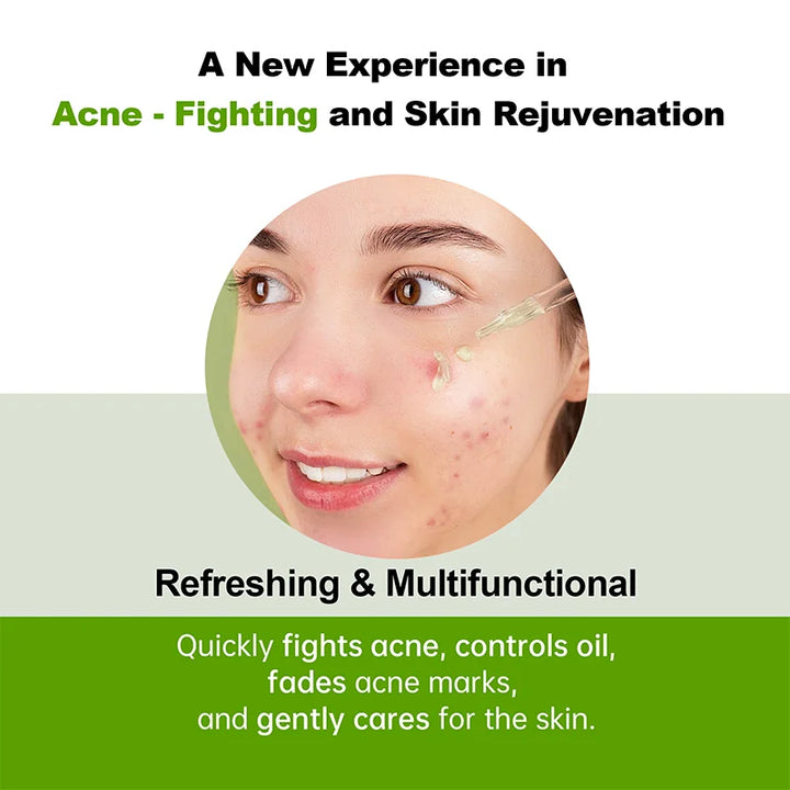 AUQUEST Salicylic Acid Acne Treatment Face Serum Oil Control Herbal Fades Acne Marks Pimple Remover Facial Skin Care