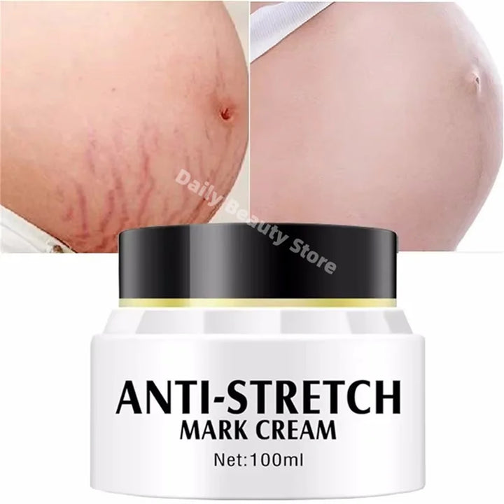 Removes Stretch Mark Cream Postpartum Repair Fade Stretch Marks Prevent Obesity Lifting Firming Moisturizing Brighten Skin Care