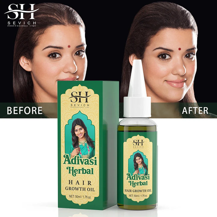 Ayurvedic Hair Growth Oil India Adivasi Organic Hair Growth Serum Anti Hair Loss Fast Regrowth Thicken Oils Hair Growth Products