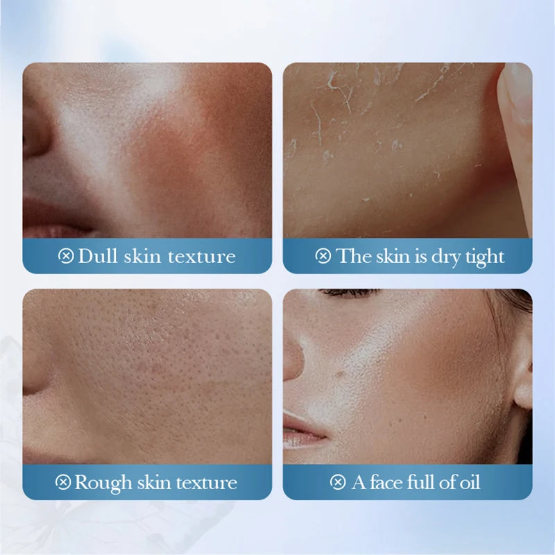 SADOER Lily Hyaluronic Acid Face Mask Moisturizing Sheet Masks Hydrating Anti-Aging Wrinkle Facial Masks Beauty Skin Care