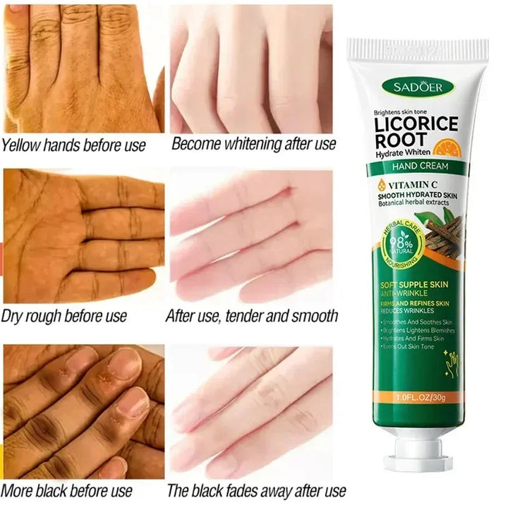 Fast Whitening Hand Cream Dark Knuckles Brighten Moisturizing Intense Stains Remover Melanin Corrector Products hand Skin Care