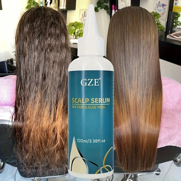 GZE Scalp Serum With Tea Tree & Aloe Vera Leave-In Conditioner Remove loose dandruff flakes For Dry Scalp for Women and Men