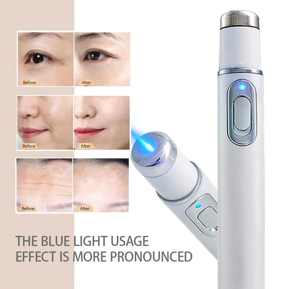 HOT Facial Beauty Device Eye Massager Blue Light Black Eye Circles Facial Care Tool Lightening Texture Maintaining Eye Bags