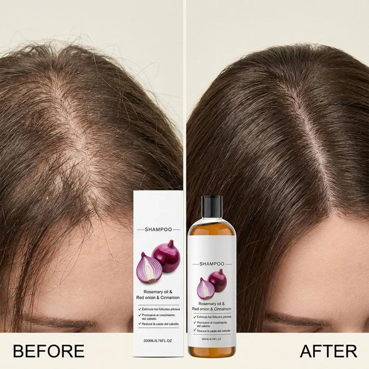 Rosemary Red Onion Shampoo/Conditioner Anti Hair Loss Promote Thicker Stronger excalvo Shampoo/Conditioner Hair Care