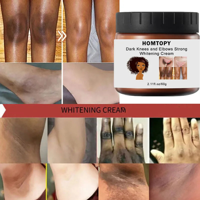 Whitening Cream Private Parts Underarm Bleaching Serum Whiten Butt Knee Brighten Inner Thigh Intimate Parts Dark Remove Melanin