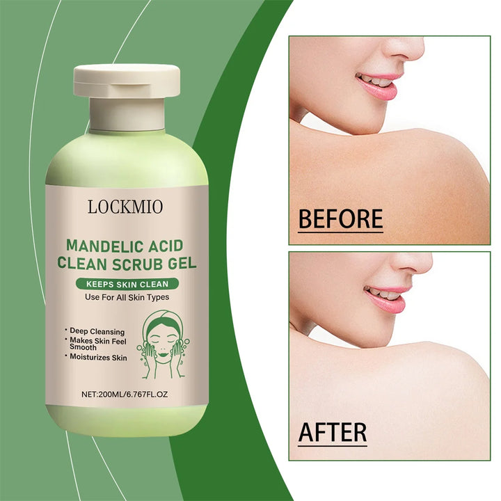 Mandelic Acid Clean Scrub Gel Gentle Exfoliator Dead Smooth Skin Care Product Deep Clean Scrub Improve Facial Texture Appearance