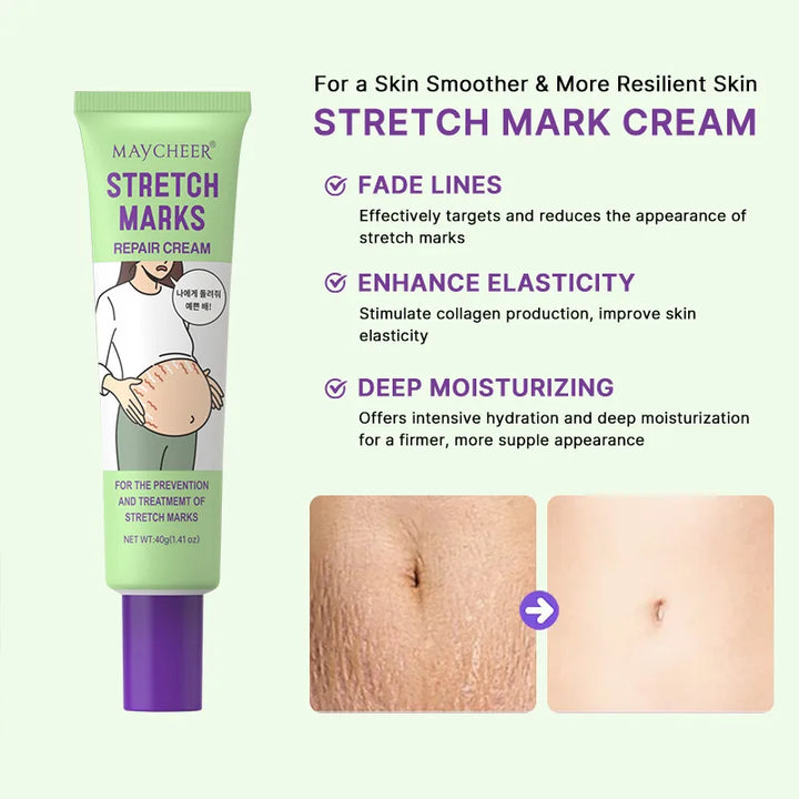 Stretch Marks Repair Cream Fade Lines Improve Duliness Tightness Long-lasting Moisturizing Smooth Enhance Elasticity Body Care
