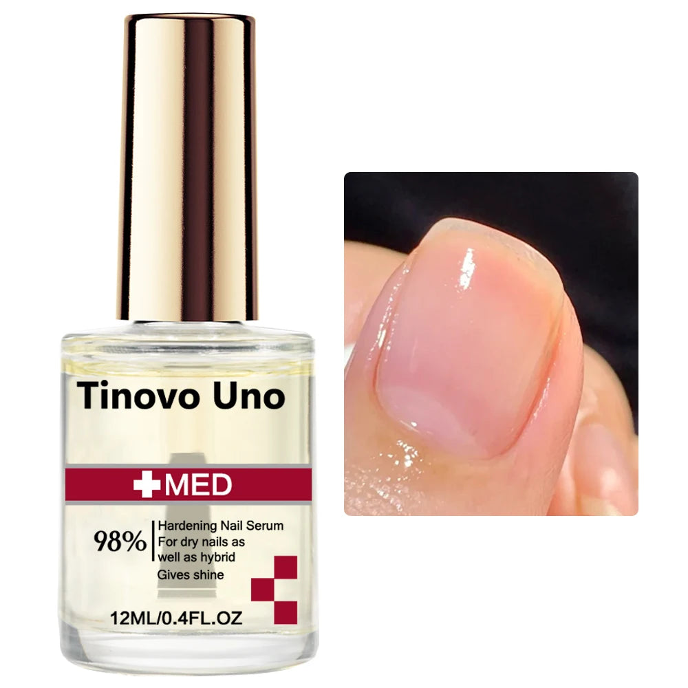 Tinovo Uno Keratin Coconut Nail Strengthening Oil Nail Art Treatment Care Nail Growth Cuticle Oil 12ML Vitamin C Enriched Polish