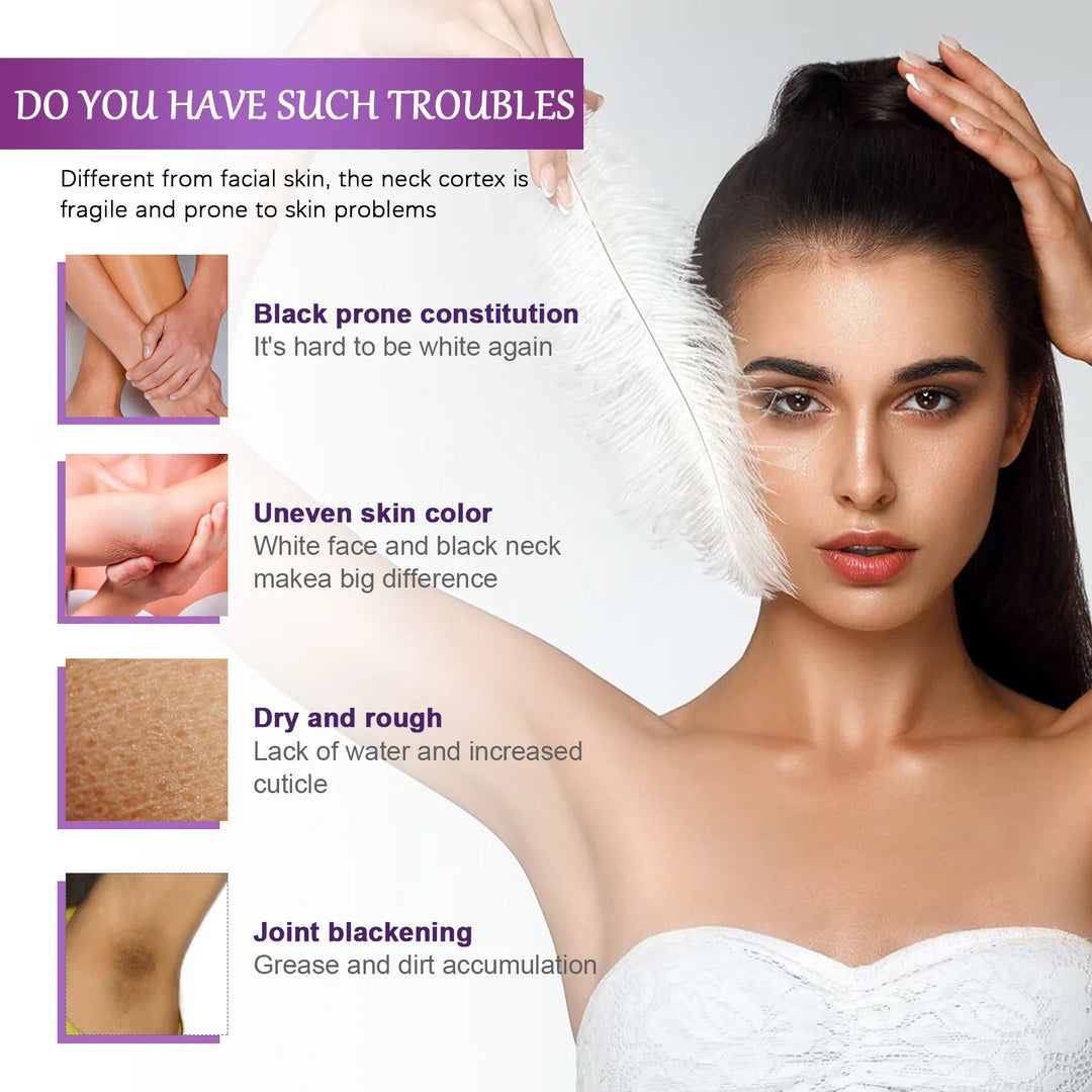 Body Whitening Cream Fade Joint Elbow Knee Armpit Pigmentation Underarm Melanin Bleaching Moisturizing Dark Spot Corrector Cream