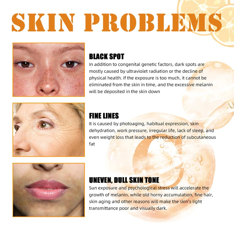 Vitamin C Whitening Serum Effective Remove Dark Spots Freckles Fade Melanin Anti-Wrinkle Brightening Nourishing Face Skin Care