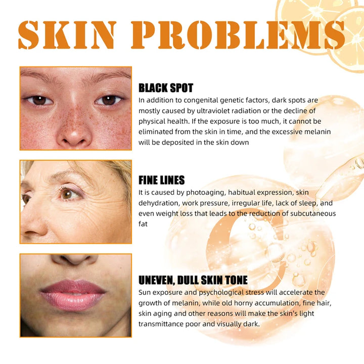 Vitamin C Whitening Serum Effective Remove Dark Spots Freckles Fade Melanin Anti-Wrinkle Brightening Nourishing Face Skin Care