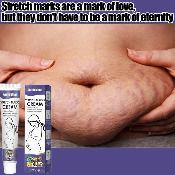 Stretch Mark Removal Cream Permanently Removes Stretch Marks Rejuvenates Skin Stretch Mark Removal Cream