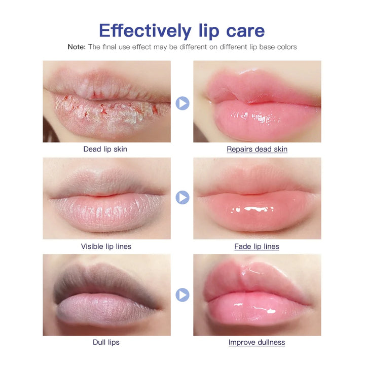 Hose Lip Care Repair Gel Cream Hydrating Hydrating Hydrating Hydrating Dryness Soothing Chapping Hydrating Repair Lip Balm