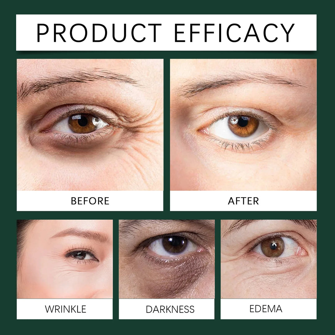 Mint Eye Serum Contains Vitamin C To Reduce Fine Lines and Crow's Feet. Moisturizing Eye Care Products. Skin Care Products