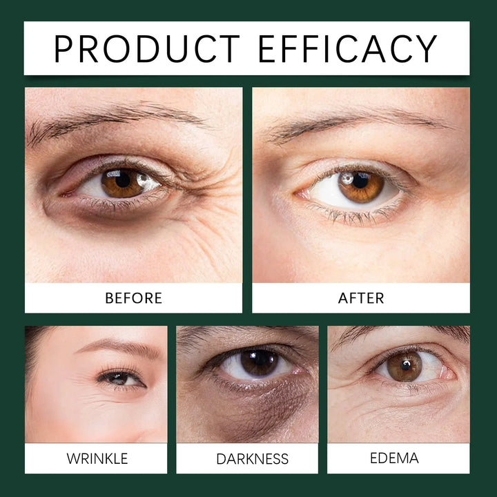 Mint Eye Serum Contains Vitamin C To Reduce Fine Lines and Crow's Feet. Moisturizing Eye Care Products. Skin Care Products