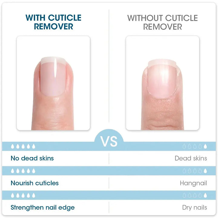 QAZIXU 10ml Nail Care Cuticle Remover Nail Polish for Dead Skin Gel Manicure Treatment Tool For Nail Art DIY Cleaner Tool
