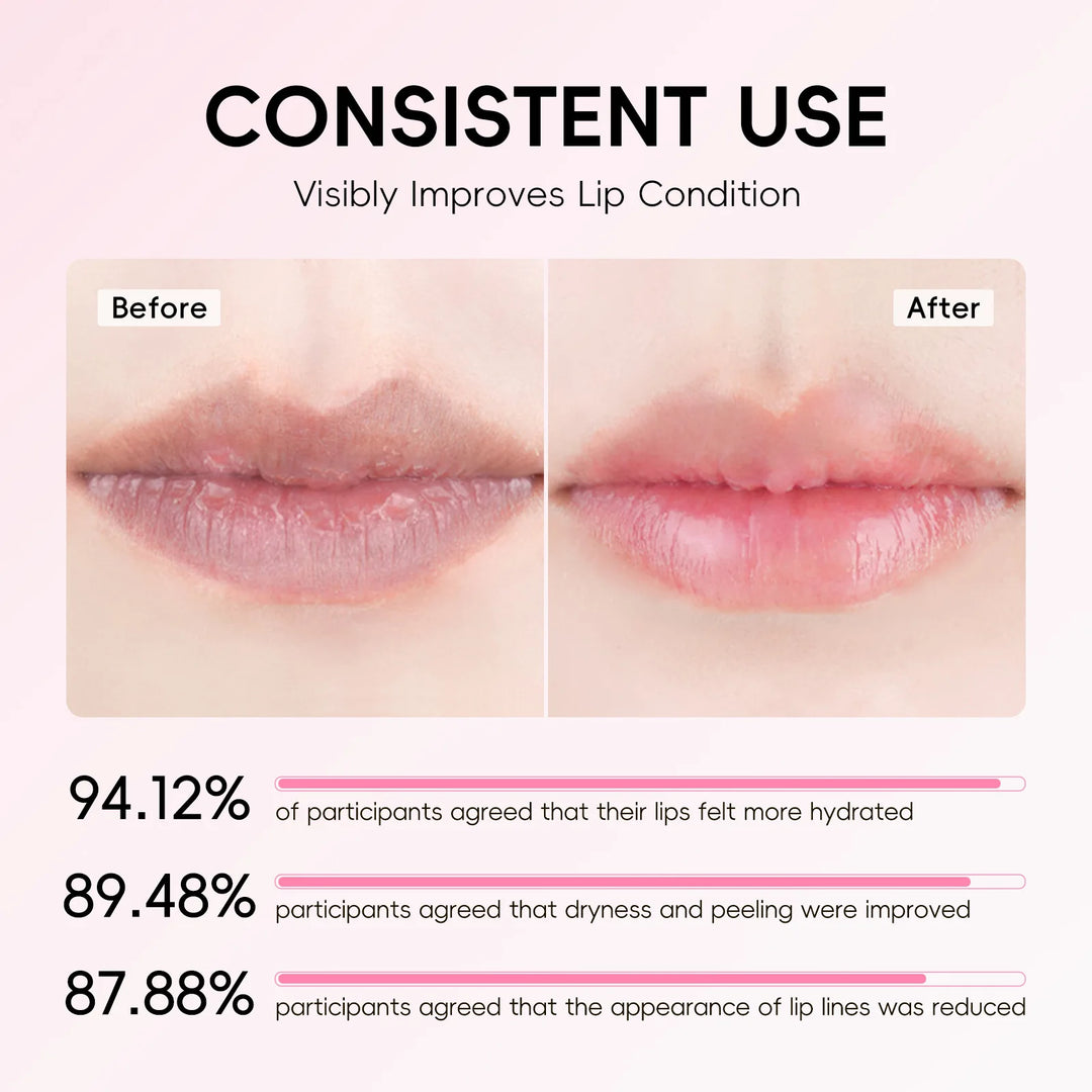 LAIKOU Japan Sakura Lip Balm 3.5g Shea Butter Vitamin E Nourishing Hydrating Moisturizer For Dry Chapped Lips Daily Lip Repair
