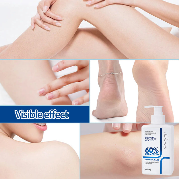 Urea Cream 60% Unisex Whole Body Lotion Moisturizer Hydrates & Nourishes Foot Care for Softening Skin for Dry Cracked Rough Skin