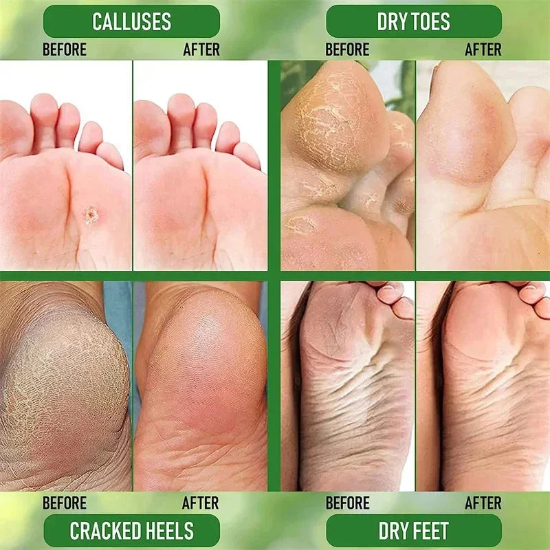 Herbal Anti Crack Foot Cream Heel Cracking Repair Products Exfoliation Dead Skin Removal Softening Moisturize Smooth Skin Care