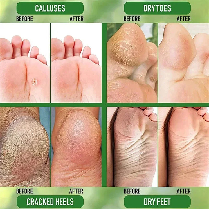 Herbal Anti Crack Foot Cream Heel Cracking Repair Products Exfoliation Dead Skin Removal Softening Moisturize Smooth Skin Care