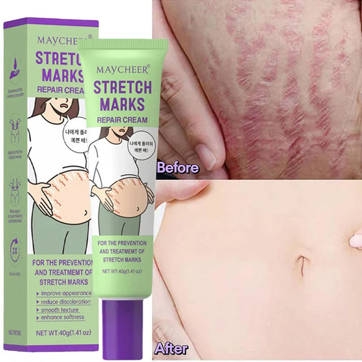 Stretch Marks Repair Cream Fade Lines Improve Duliness Tightness Long-lasting Moisturizing Smooth Enhance Elasticity Body Care