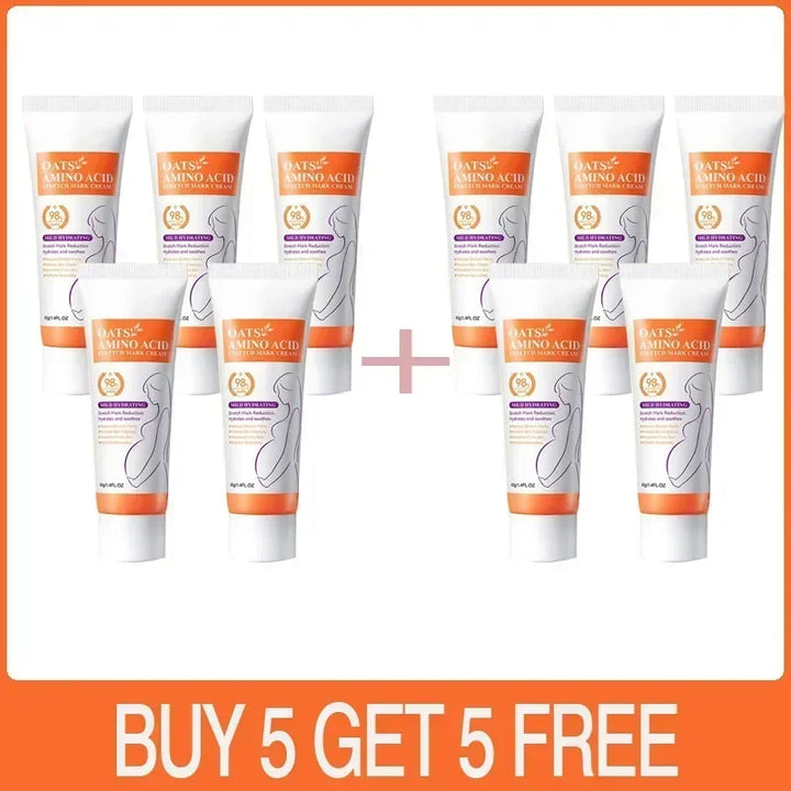 Cream For Pregnancy Stretch Marks Removal Eliminate Red White Old Stretch Marks  2025