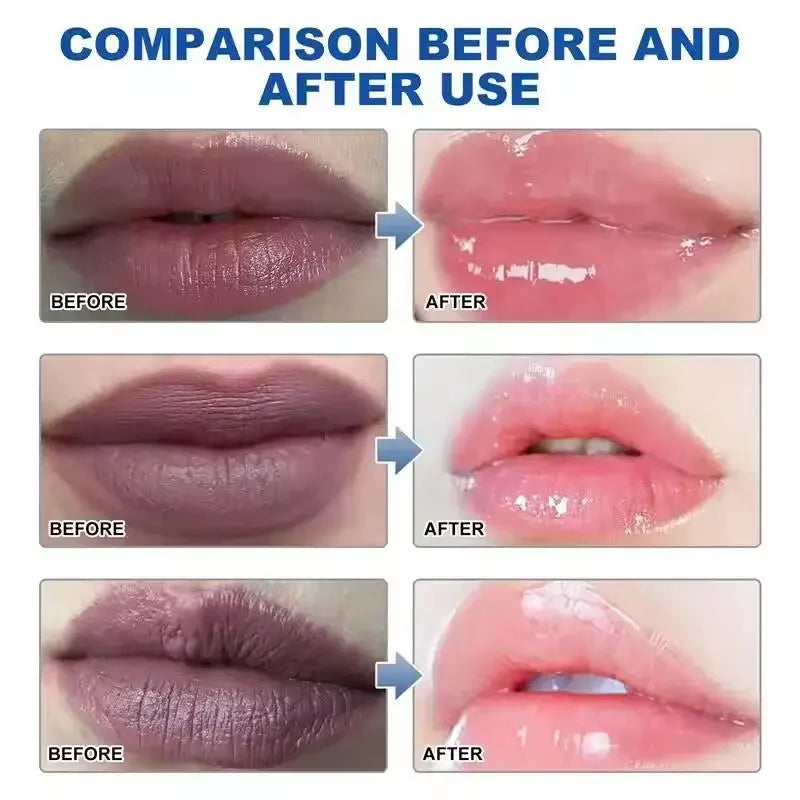 Lip Balm For Remove Dark Lip Melanin Dead Skin Removal Lighten Exfoliate Whitening Moisturizing Nourishing Lip Care
