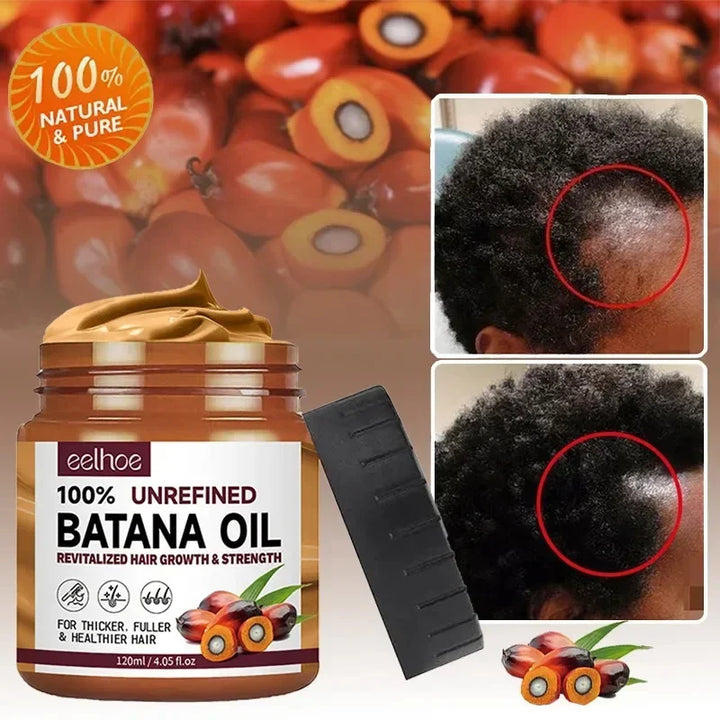 Batana Hair Growth Oil Conditioner Anti Hair Loss Products Fast Growing Hair Mask Nourishing Repair Roots Hair Care for women