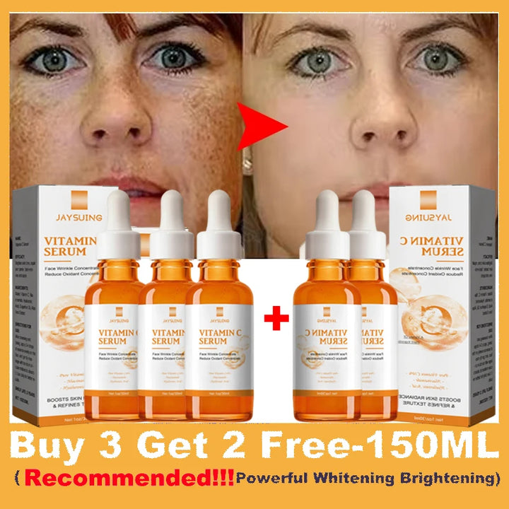 Vitamin C Whitening Serum Effective Remove Dark Spots Freckles Fade Melanin Anti-Wrinkle Brightening Nourishing Face Skin Care