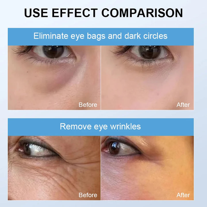 Eye Massager Dark Circles Puffiness Wrinkle Removal Hot Cold Microcurrent Mode Collagen Boosting Eye Fatigue ReliefAntiAgingTool