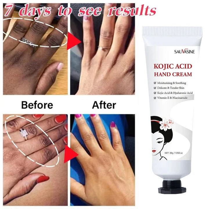 Dark Knuckles Fast Brighten Cream Elbows Hand Knuckle Brightening Serum Knee Black Skin Quickly Lighten Stains Remover Essence