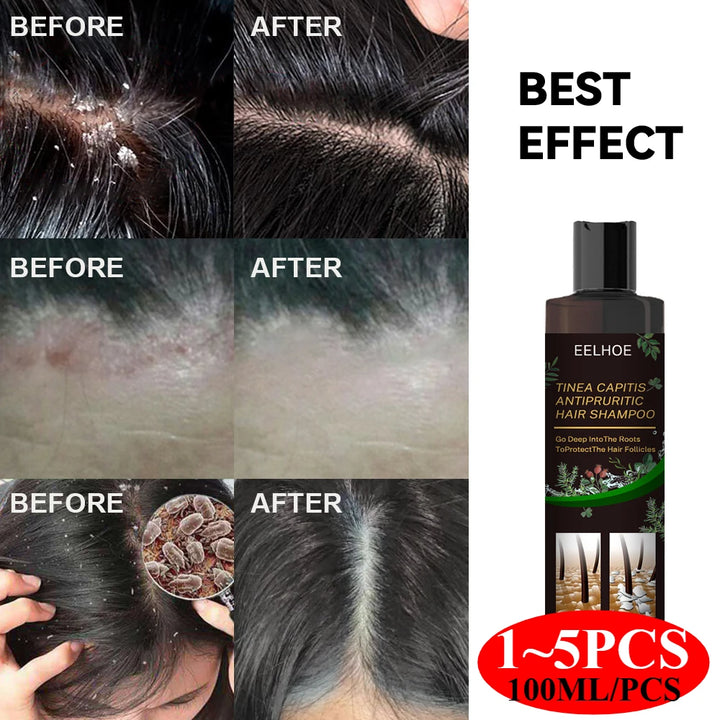 Natural Herbal Hair Shampoo Deep Nourish Moisturize Scalp Care Hair Washing Lotion Professional Anti Dandruff Remove Mites