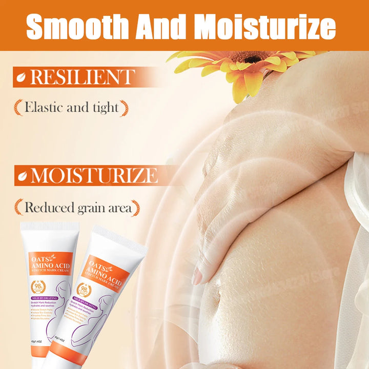 Stretch Marks Removal Cream Light Lines Postpartum Obesity Pregnancy Powerful Fast Absorption