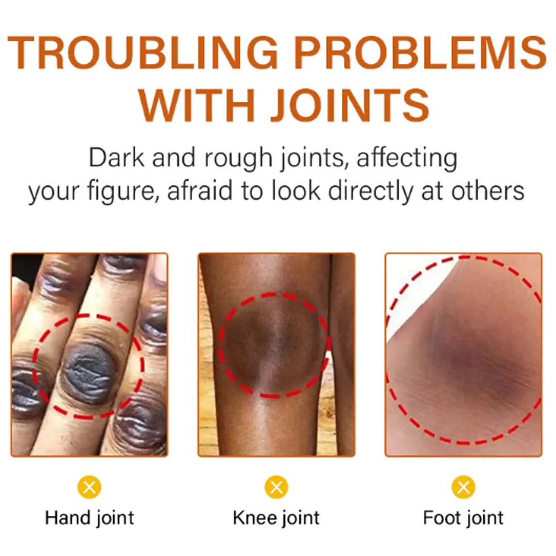Body Whitening Bleach Cream Brighten Underarm Elbow Knees Joint Removal Intimate Parts Dark Spots Melanin Snow Bleach Cream