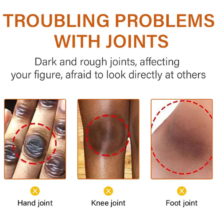 Body Whitening Bleach Cream Brighten Underarm Elbow Knees Joint Removal Intimate Parts Dark Spots Melanin Snow Bleach Cream