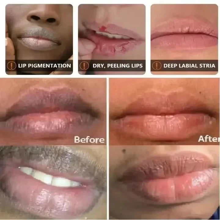 Fast-Acting Dark Lip Balm Leaching Permanent Remove Dark Smoke Lips Lip Balm Moisturize Gloss Lipstick Beauty Health Lip Care