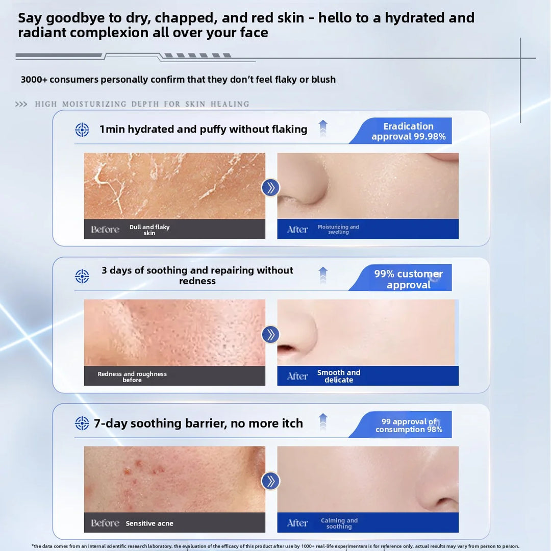 RUYI B5 Face Cream Deep Hydration Lock Moisturizing Soothing Redness Barrier Protection Autumn & Winter Special Skin Care 50g